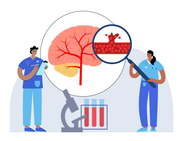 圍產(chǎn)期中風(fēng)-類(lèi)型、原因和風(fēng)險因素