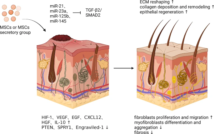 圖6：間充質(zhì)干細胞促進(jìn)皮膚疤痕修復的機制。