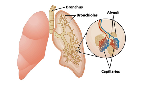 慢性阻塞性肺病如何影響肺部？