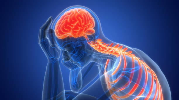 什么是缺血性腦中風(fēng)，癥狀、原因、診斷和治療