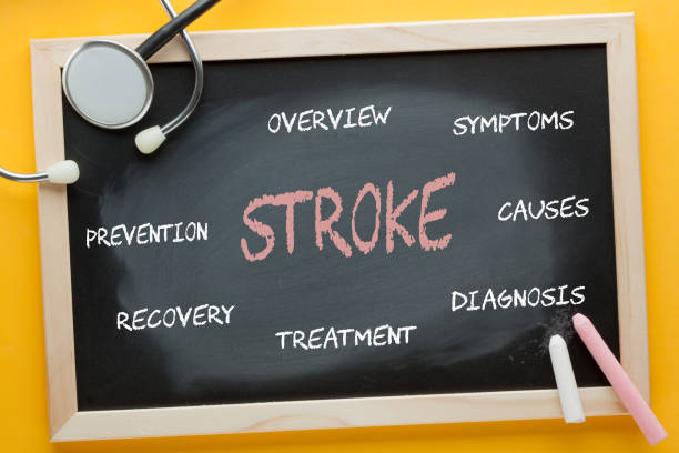 科普丨什么是中風(fēng)？干細胞治療中風(fēng)的機制與臨床研究進(jìn)展