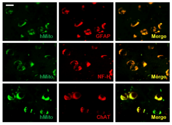 干細胞移植到小鼠腦組織后分化成神經(jīng)元和星細胞