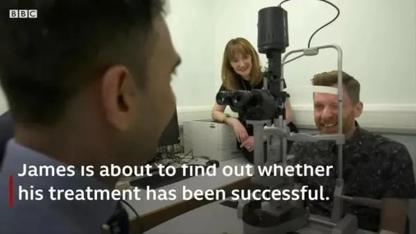 干細胞治療燒傷失明臨床案例 干細胞治療燒傷失明臨床案例