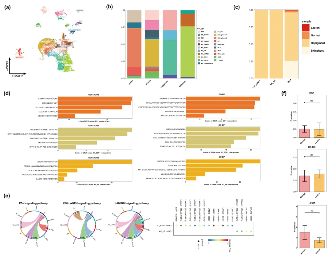 2024年干細胞治療白癜風(fēng)臨床案例