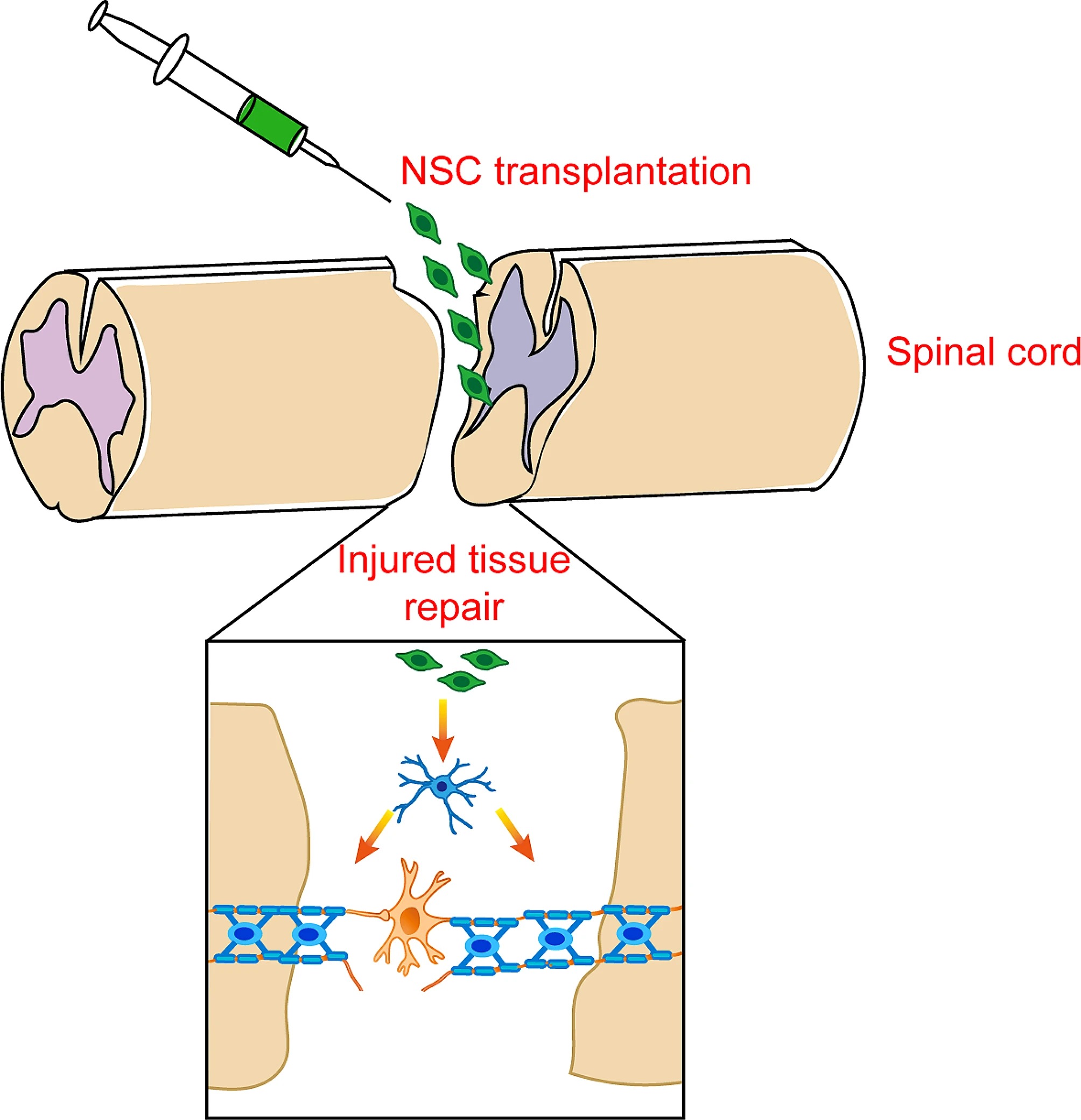 圖3：神經(jīng)干細胞移植在脊髓損傷修復和恢復中的應用