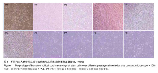 不同代次人臍帶問(wèn)充質(zhì)于細胞的形態(tài)學(xué)表現