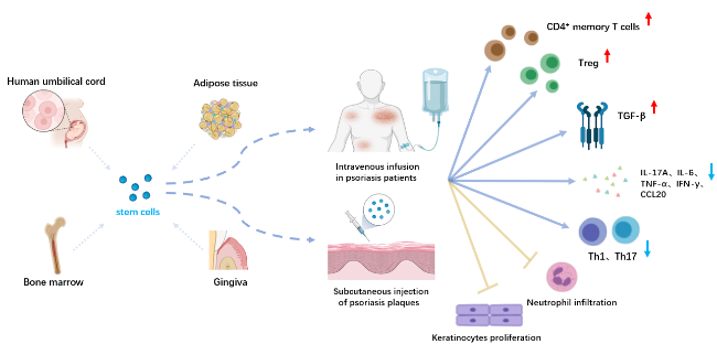 圖1：干細胞在牛皮癬治療中的應用