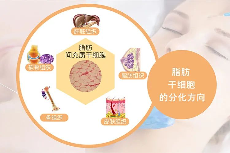 什么是脂肪干細胞：脂肪干細胞來(lái)源、臨床應用