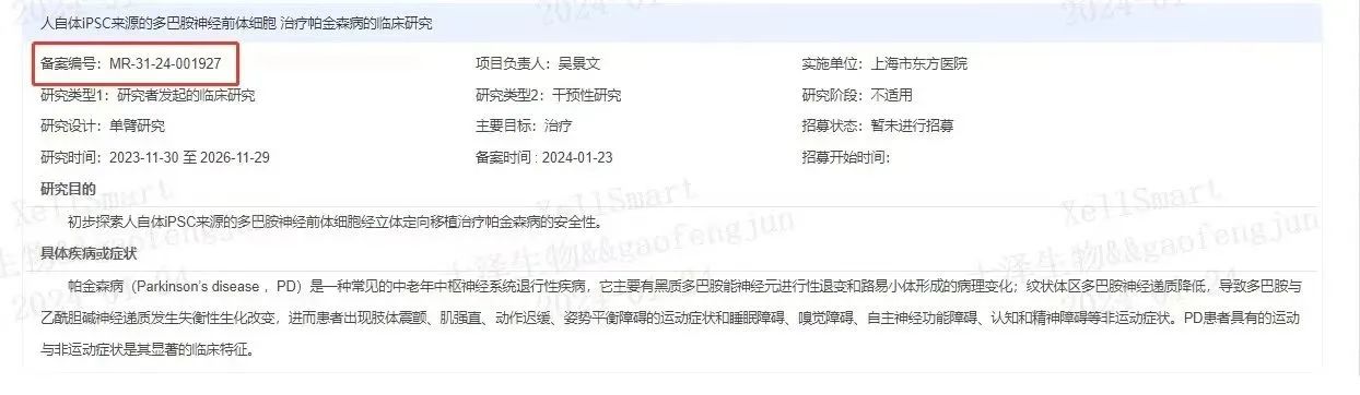 臨床級iPSC衍生多巴胺能神經(jīng)前體細胞治療帕金森病的臨床研究
