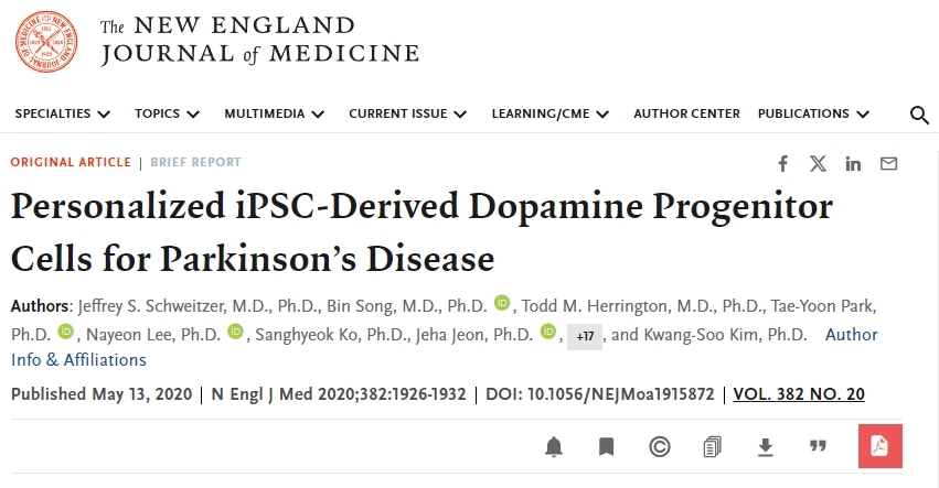 個(gè)性化 iPSC 衍生的多巴胺祖細胞用于治療帕金森病