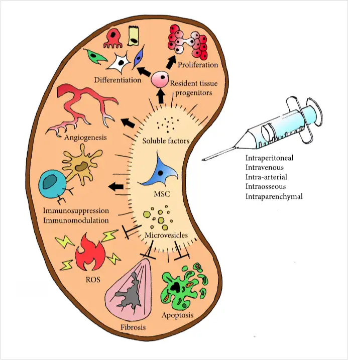 干細胞如何治療腎臟疾??？