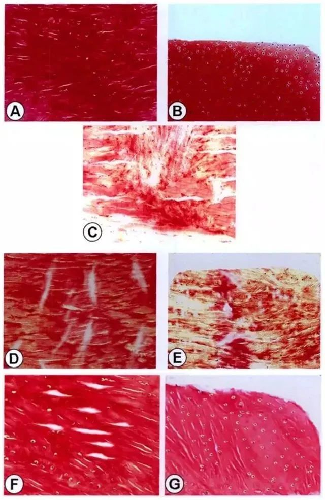 不同時(shí)間點(diǎn)修復組織紅-紅區與白-白區II型膠原表達量
