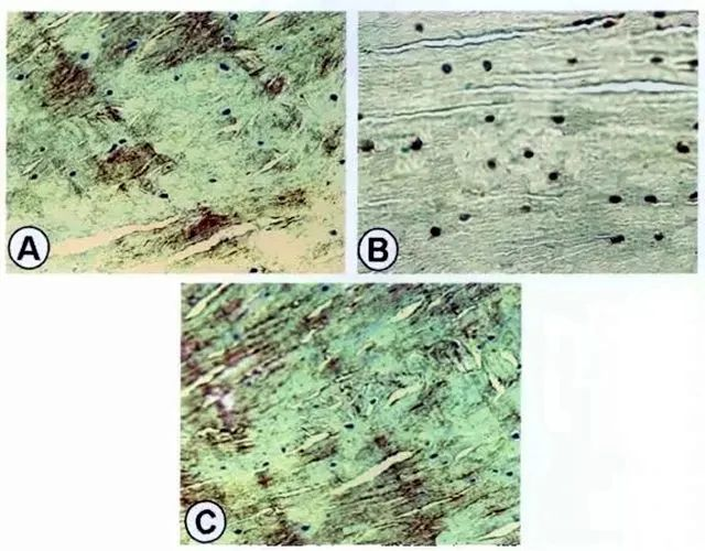 A為紅-紅區修復組織II型膠原的表達；B為紅-紅區修復組織S-100蛋白表達；C為紅-紅區修復組織I型膠原表達。
