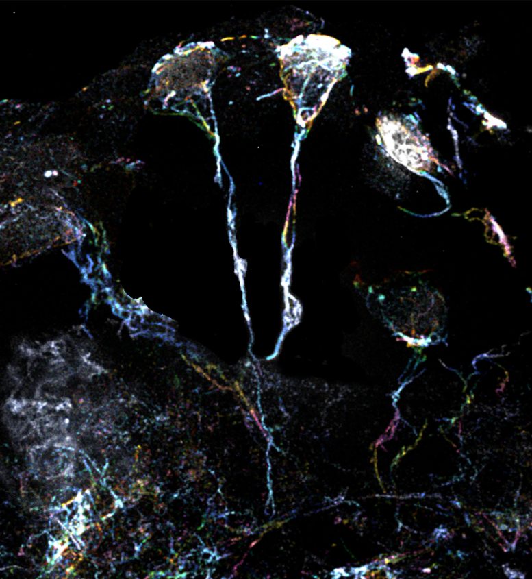 果蠅大腦中處于休眠狀態(tài)的神經(jīng)干細胞具有富含肌動(dòng)蛋白絲的突起