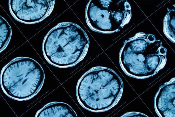 8.干細胞治療神經(jīng)系統疾病