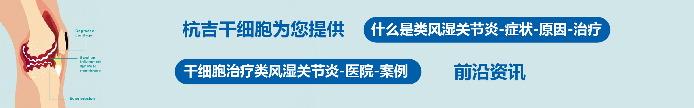 國內外干細胞醫院治療類(lèi)風(fēng)濕關(guān)節炎的臨床案例