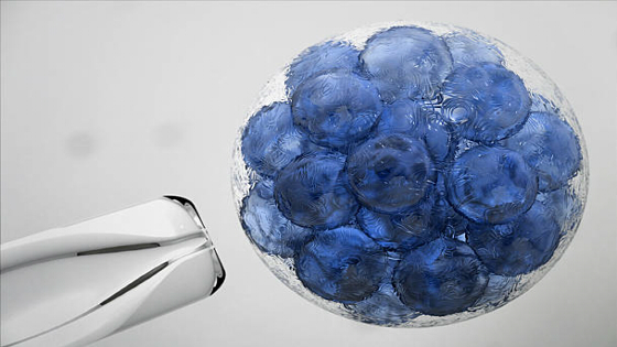 干細胞治療精神分裂癥的作用機制