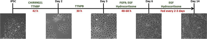 圖3：人類(lèi) iPSC腎臟分化示意圖