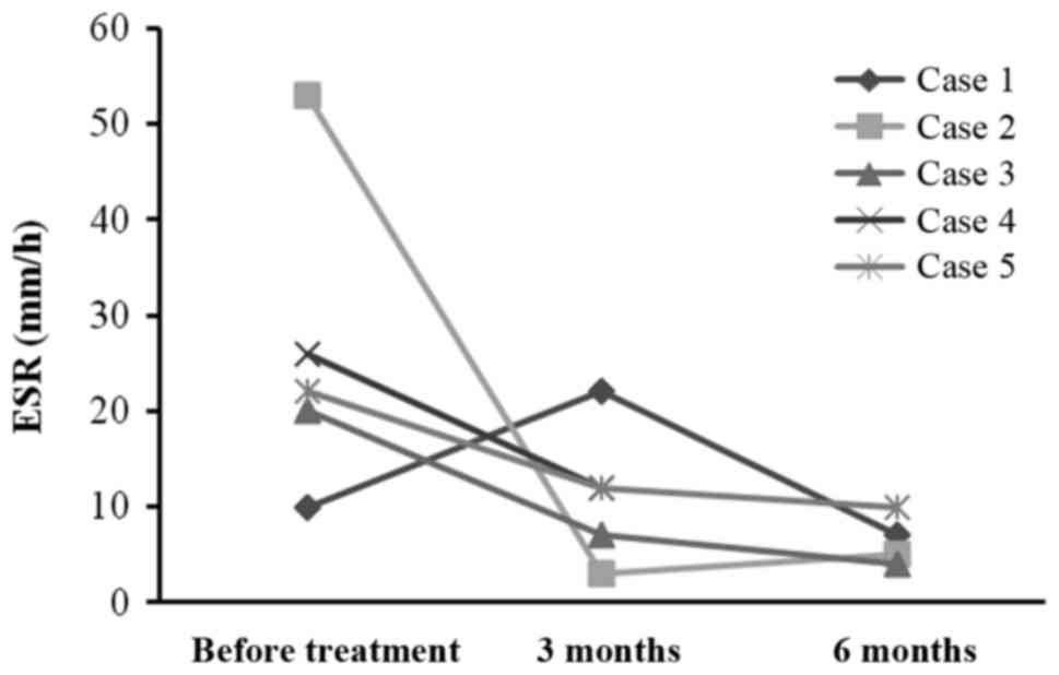 每位患者治療前后的 CRP 水平。1 名患者的 CRP 水平降低，而其他 4 名患者的 CRP 水平保持穩定并在正常范圍內。CRP，C 反應蛋白。
