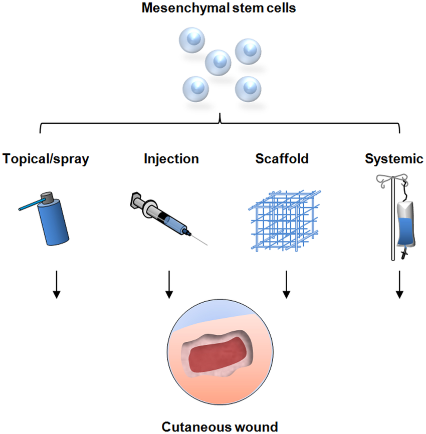 間充質(zhì)干細胞的治療方式有哪些—從傳統細胞移植到現代生物技術(shù)的應用 間充質(zhì)干細胞的治療方式有哪些—從傳統細胞移植到現代生物技術(shù)的應用