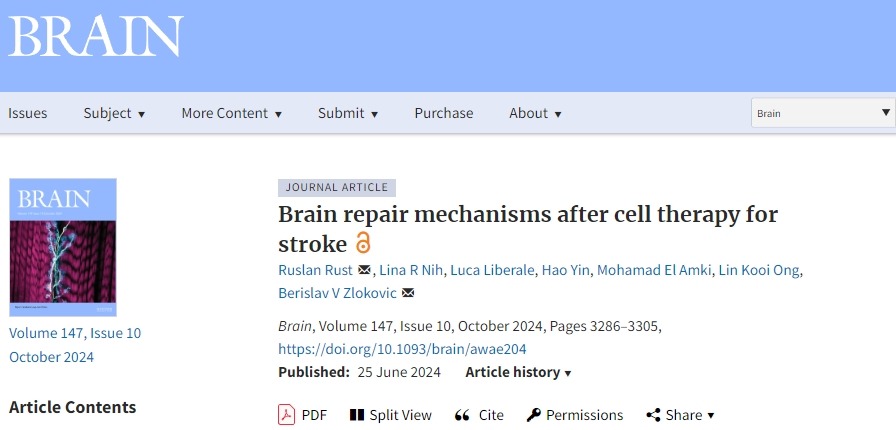 確認干細胞治療中風(fēng)后的大腦修復機制，以推動(dòng)干細胞治療中風(fēng)進(jìn)入臨床至關(guān)重要！