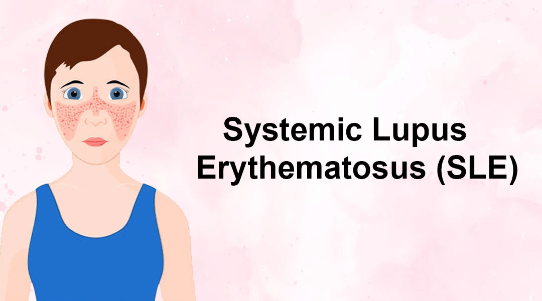 間充質(zhì)干細胞治療系統性紅斑狼瘡3大作用機制，你都了解嗎？