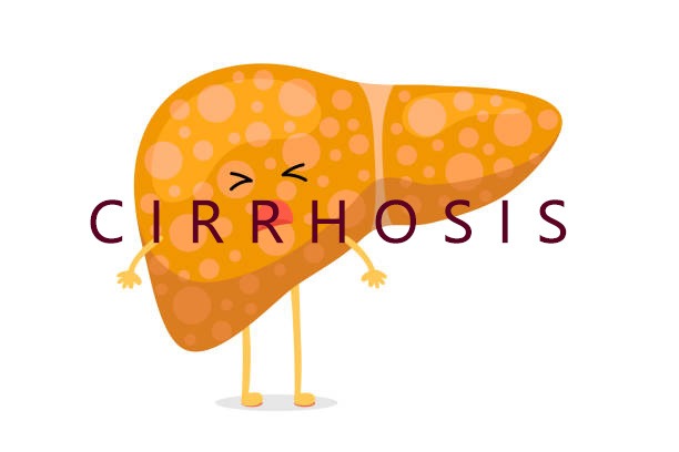 2020-2024年干細胞治療肝硬化的臨床研究進(jìn)展