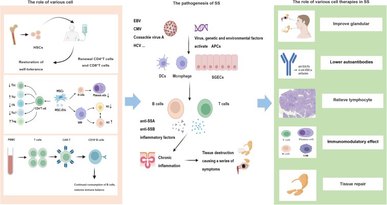 圖1：干燥綜合征的發(fā)病機制和細胞治療