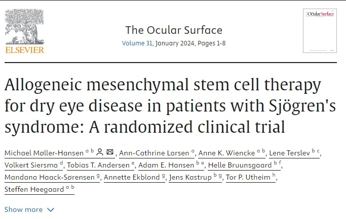 同種異體間充質(zhì)干細胞治療干燥綜合征患者干眼癥：一項隨機臨床試驗
