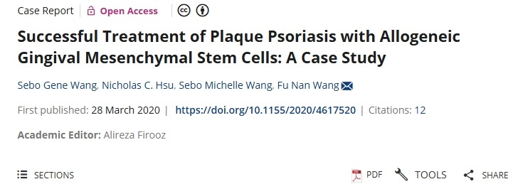 用同種異體牙齦間充質(zhì)干細胞成功治療斑塊狀銀屑?。喊咐芯? class=