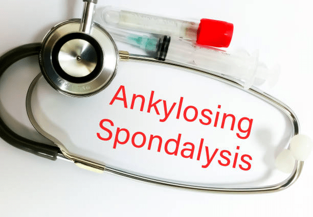 2019-2024年干細胞治療強直性脊柱炎臨床研究進(jìn)展