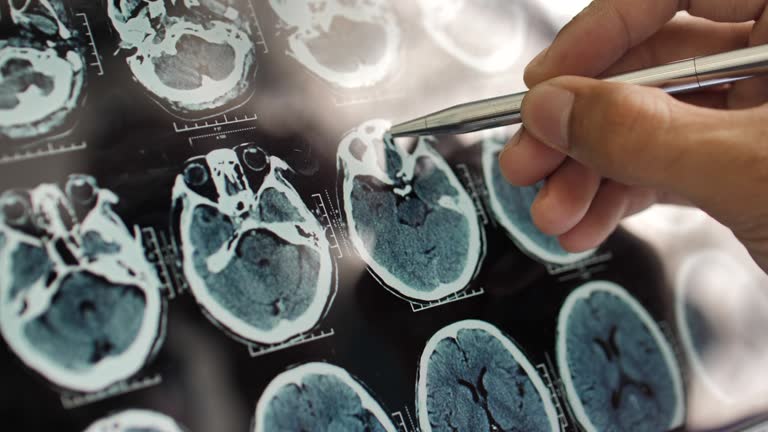 事關(guān)神經(jīng)退行性疾病，干細胞在治療神經(jīng)退行性疾病的療效、倫理、安全等問(wèn)題的綜述