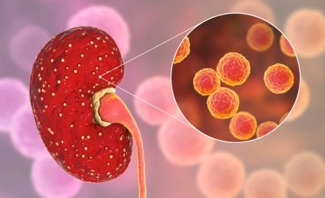 干細胞治療狼瘡性腎炎的安全性怎么樣？盤(pán)點(diǎn)國內外臨床進(jìn)展！