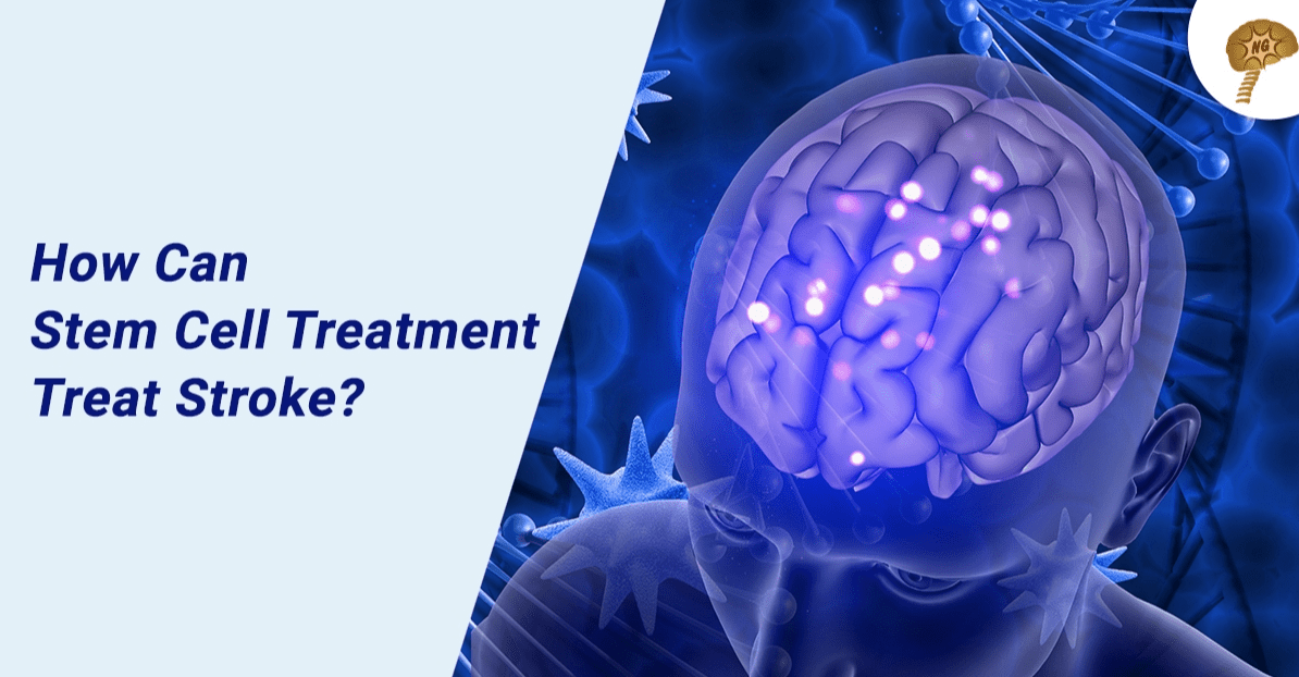 急性缺血性腦卒中——全球健康的沉重負擔