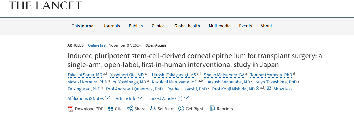 《誘導性多能干細胞來(lái)源的角膜上皮用于移植手術(shù)：日本的一項單臂、開(kāi)放標簽、首次人體介入研究》
