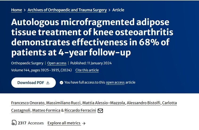 自體微碎片脂肪組織治療膝關(guān)節骨關(guān)節炎在4年隨訪(fǎng)中顯示對68%的患者有效