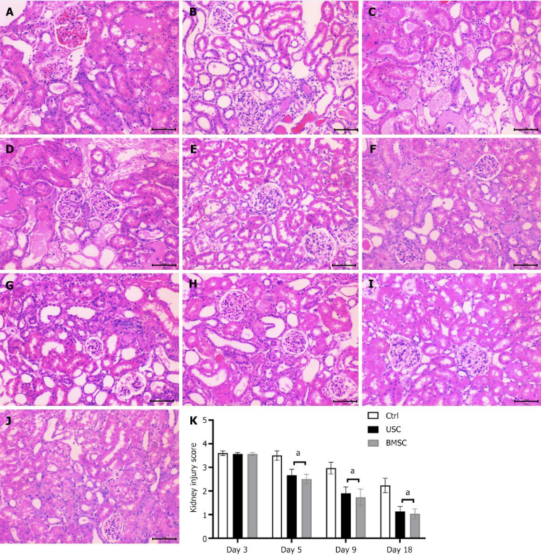 圖4：通過(guò)蘇木精和伊紅染色（200 ×）對尿液來(lái)源的干細胞治療、骨髓間充質(zhì)干細胞治療和對照未治療小鼠的急性腎損傷進(jìn)行組織學(xué)檢查。