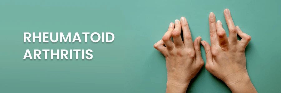 2024年最新進(jìn)展報告:干細胞療法為類(lèi)風(fēng)濕關(guān)節炎帶來(lái)希望之光 2024年最新進(jìn)展報告:干細胞療法為類(lèi)風(fēng)濕關(guān)節炎帶來(lái)希望之光