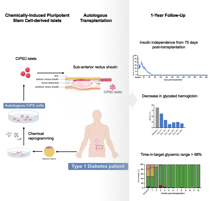 圖2：SLE患者接受CAR-T細胞治療的程序和結果。