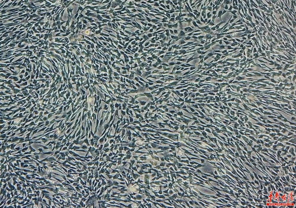 羊膜間充質(zhì)干細胞