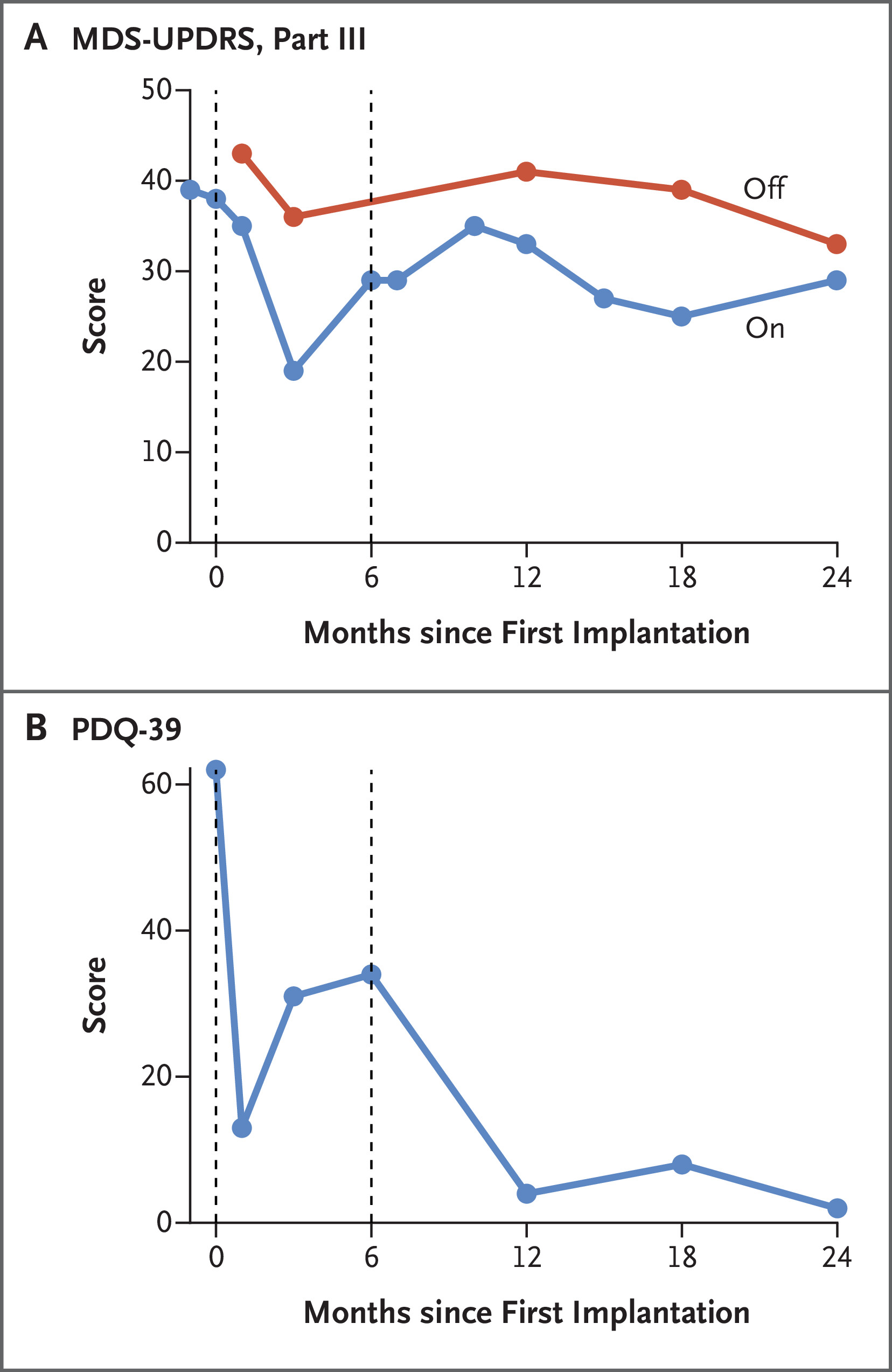 帕金森病相關(guān)運動(dòng)功能和生活質(zhì)量的縱向臨床評估