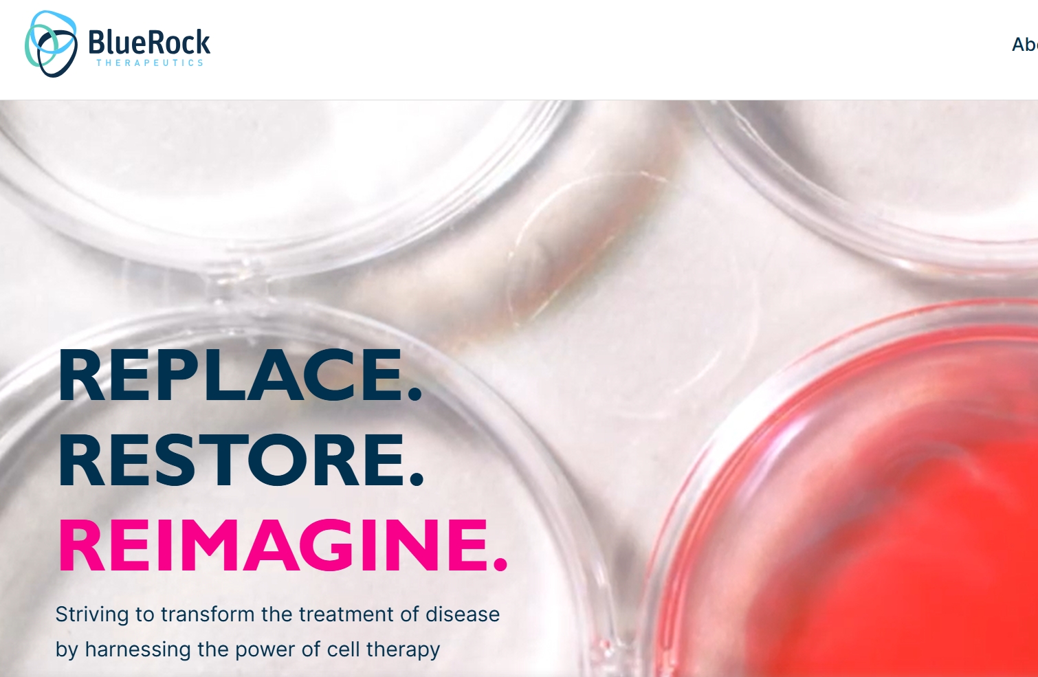 拜耳突破性干細胞治療帕金森病III期臨床試驗啟動(dòng)，開(kāi)啟治療新紀元！