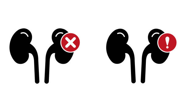 探索干細胞療法：能否成為降低腎病患者肌酐水平的新希望？