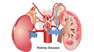 減輕負擔,延長(cháng)生命:干細胞療法對降低腎病透析并發(fā)癥的影響評估