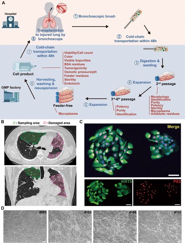 圖1：從IPF患者中分離的P63+肺祖細胞的克隆和表征。