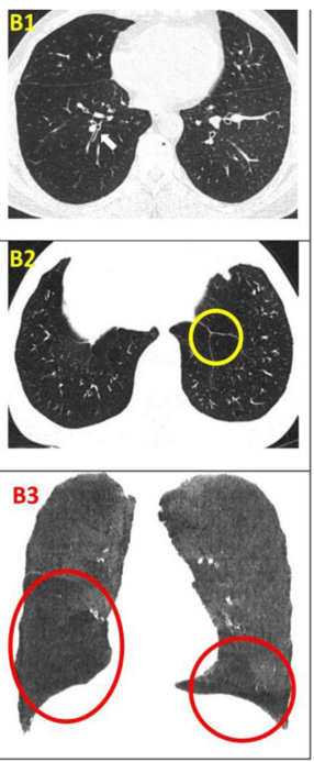 影像學(xué)檢查