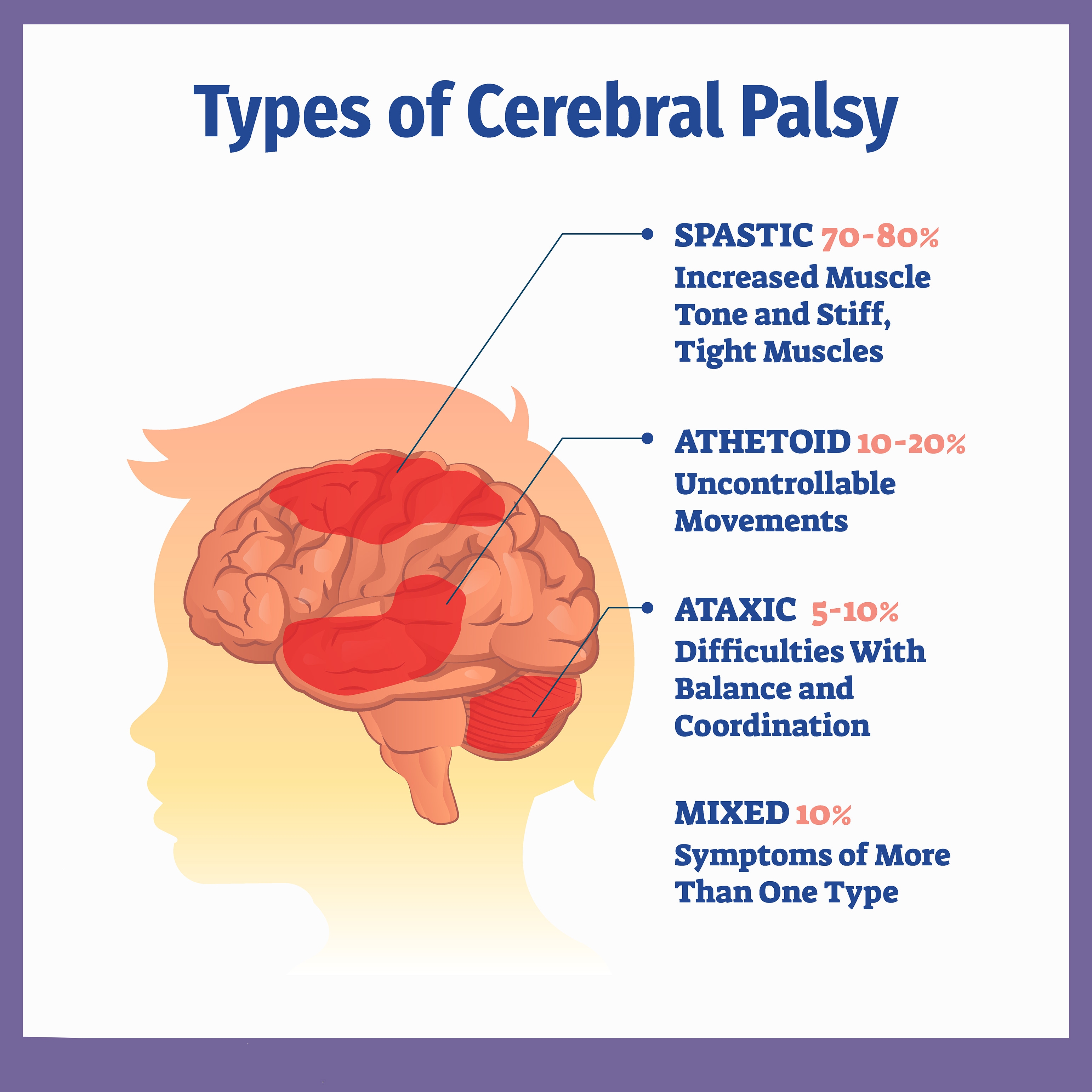 低劑量VS高劑量：不同劑量的干細胞治療腦癱哪個(gè)更加安全？