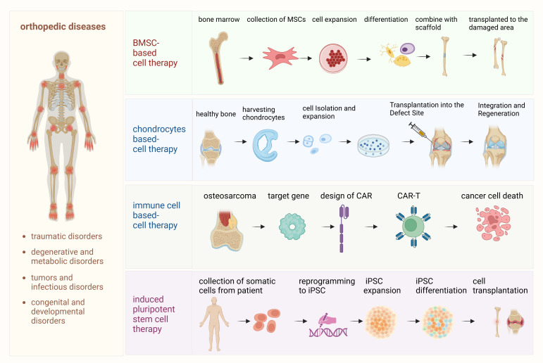圖1：骨科疾病細胞療法的詳細流程。該圖概述了用于治療骨科疾病的各種細胞療法所涉及的逐步流程。