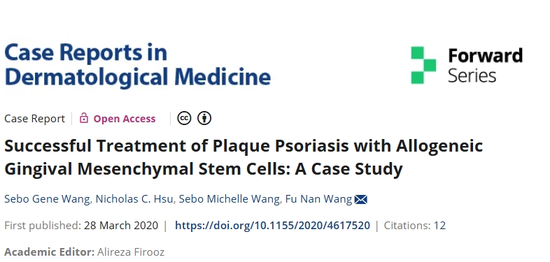 同種異體牙齦間充質(zhì)干細胞成功治療斑塊性銀屑?。喊咐芯? class=