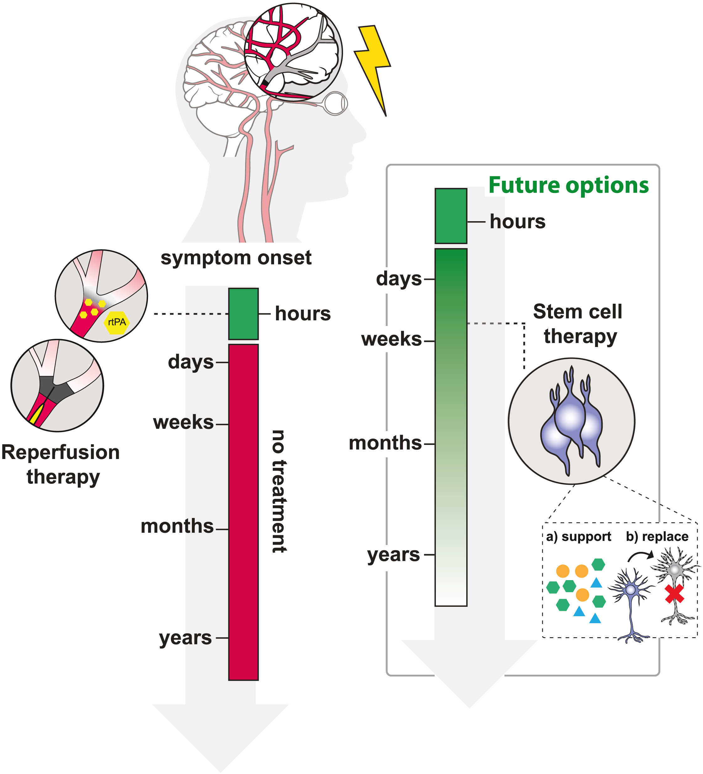 圖1：治療缺血性中風(fēng)的現有和未來(lái)選擇